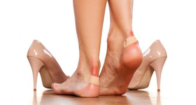 Почему высокие каблуки вредят вашему здоровью