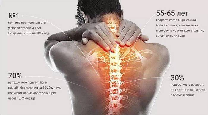 3 признака, что ваша боль в спине – серьезное заболевание