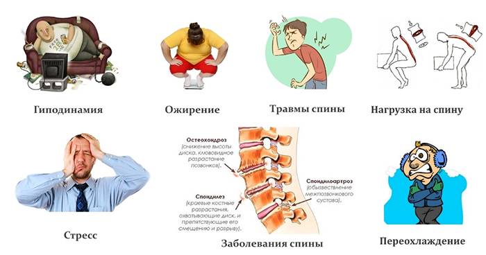 3 признака, что ваша боль в спине – серьезное заболевание