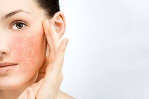 5 советов по уходу за чувствительной кожей