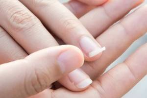 6 хитростей против ломкости ногтей