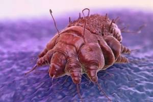 5 паразитов, которые размножаются на вашей коже и в ней