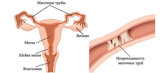 Как проверить трубы на проходимость в домашних 168
