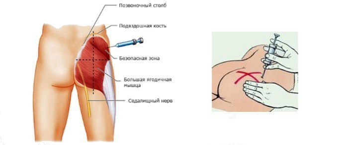 Как правильно сделать укол корове внутримышечно