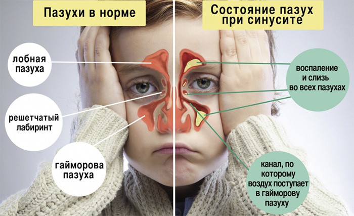 Как сделать капучино с кофеваркой Как сделать капучино с кофеваркой