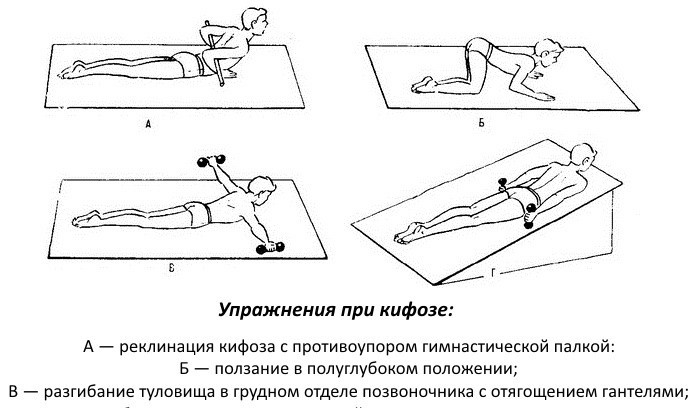 Лечебные упражнения в домашних условиях Лечебные упражнения в домашних условиях