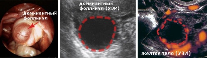 Созревает ли фолликул при беременности