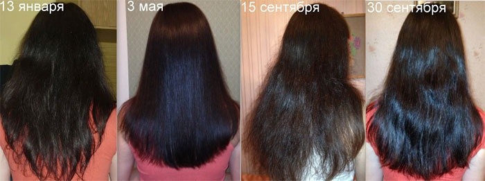 Димексид для лечения волос Димексид для лечения волос