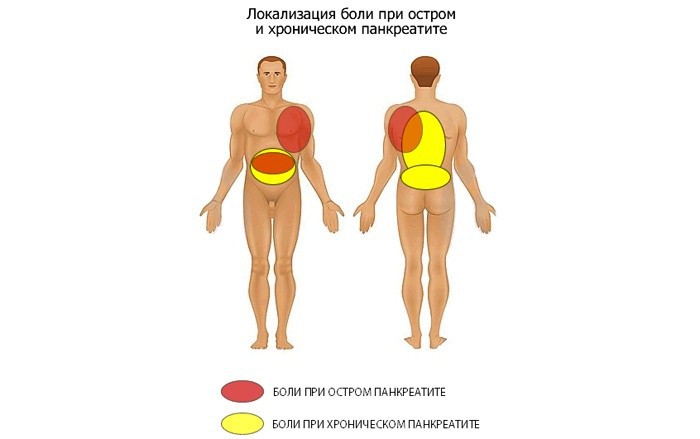 Панкреатит как снять приступ в домашних условиях Панкреатит как снять приступ в домашних условиях