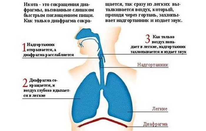 Как быстро избавится от икоты в домашних условиях Как быстро избавится от икоты в домашних условиях