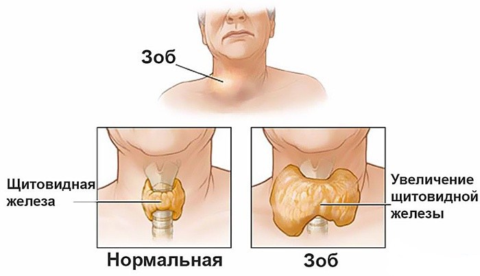 Как проверить работу щитовидной железы в домашних 725