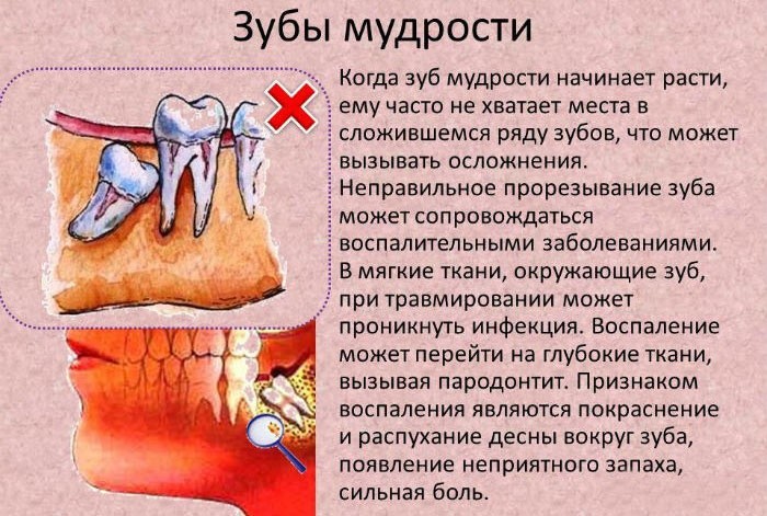Режется зуб болит десна чем обезболить в домашних условиях Режется зуб болит десна чем обезболить в домашних условиях