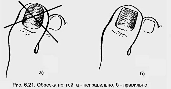 Как правильно укорачивать ногти Как правильно укорачивать ногти