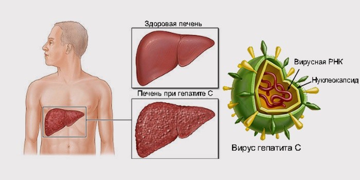 Печень при гепатите С