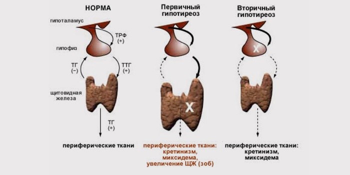 Как похудеть зимой на 10 кг