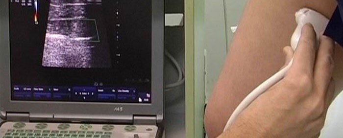 Диагностика атеросклероза сосудов ног