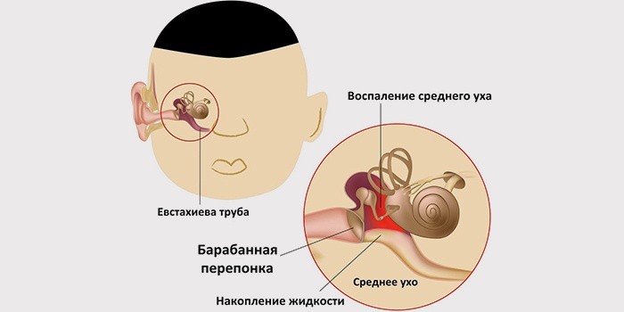 После простуды заложено ухо чем лечить в домашних условиях После простуды заложено ухо чем лечить в домашних условиях