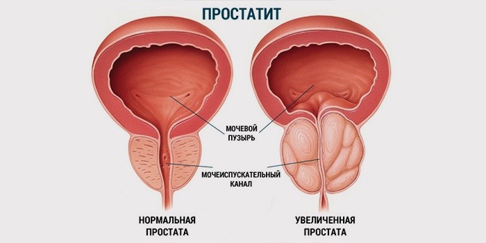 Гепатиты способ передачи