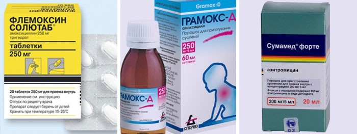 Средства от ангины в домашних условиях народными средствами Средства от ангины в домашних условиях народными средствами