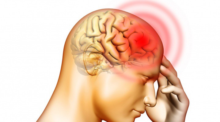 Признаки мигрени у мужчин