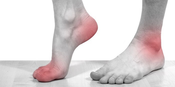 Воспаление суставов ног