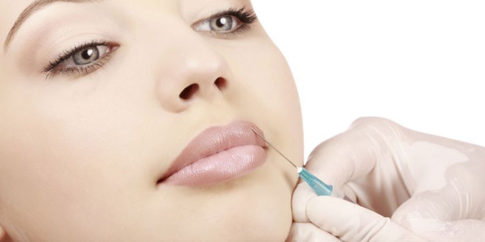 Девушке делают инъекцию в верхнюю губу