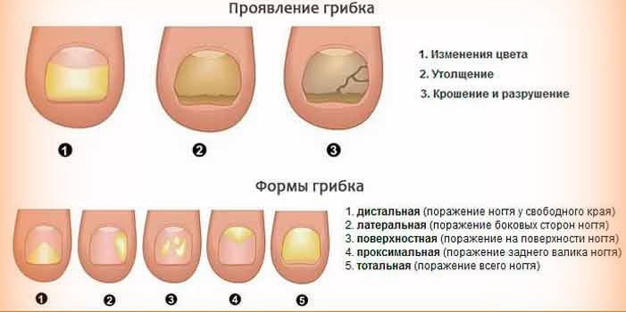 У меня гребок ногтей У меня гребок ногтей