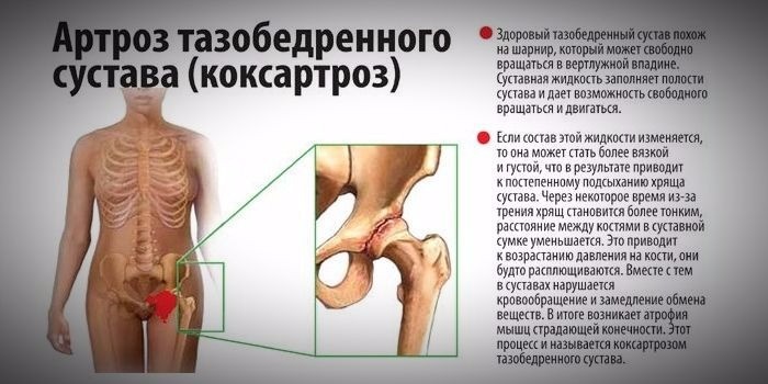алмаз лечение суставов