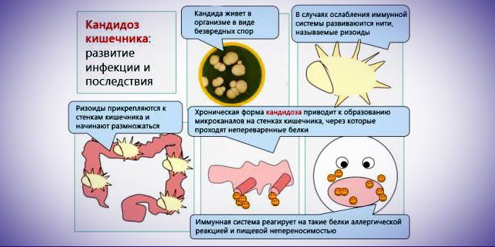 Снижен иммунитет прыщи Снижен иммунитет прыщи