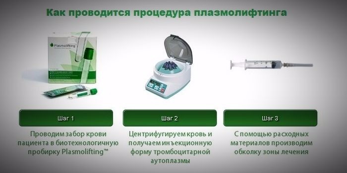 Этапы плазмолифтинга