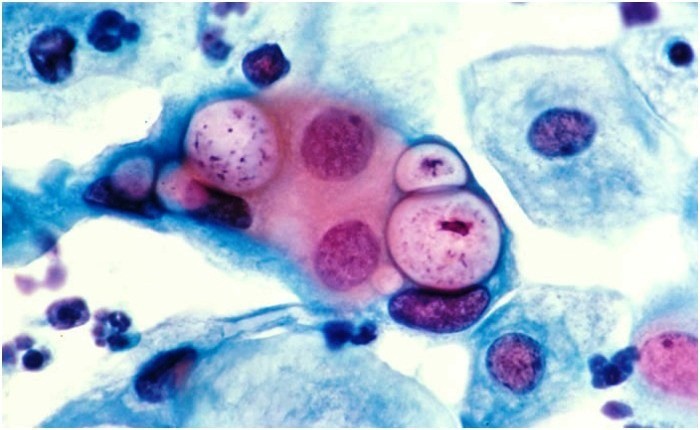 Хламидия- внутриклеточный паразит
