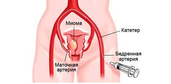 ΠΠΏΠ΅ΡΠ°ΡΠΈΡ β ΡΠ°Π½Ρ ΠΈΠ·Π±Π°Π²ΠΈΡΡΡΡ ΠΎΡ ΠΎΠΏΡΡ
ΠΎΠ»ΠΈ