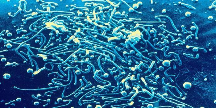 Mycoplasma pneumoniae
