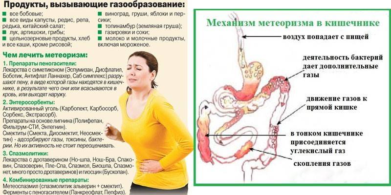 Продукты, вызывающие газообразование и механизм метеоризма