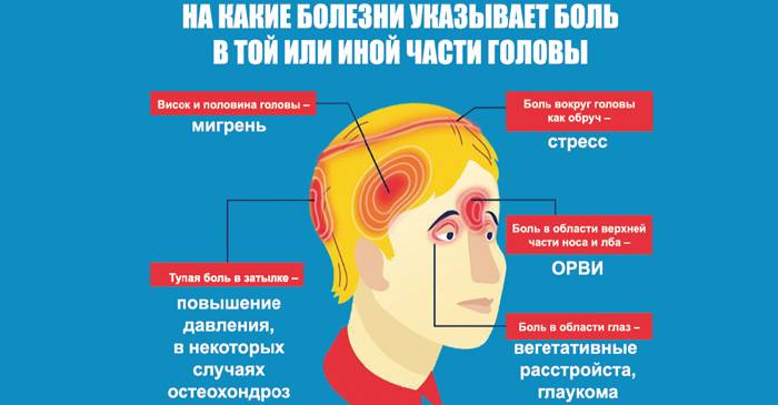Локализация головной боли