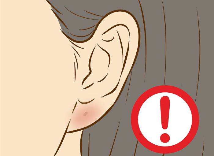 Инфицирование места прокола уха