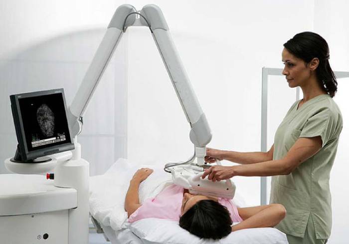 Компьютерная маммография