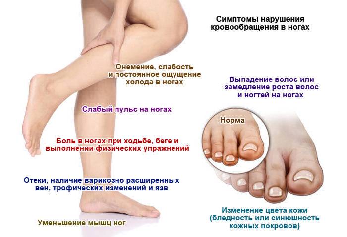 Симптомы нарушения кровообращения в ногах
