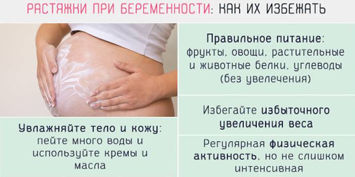 Как избежать растяжек при беременности