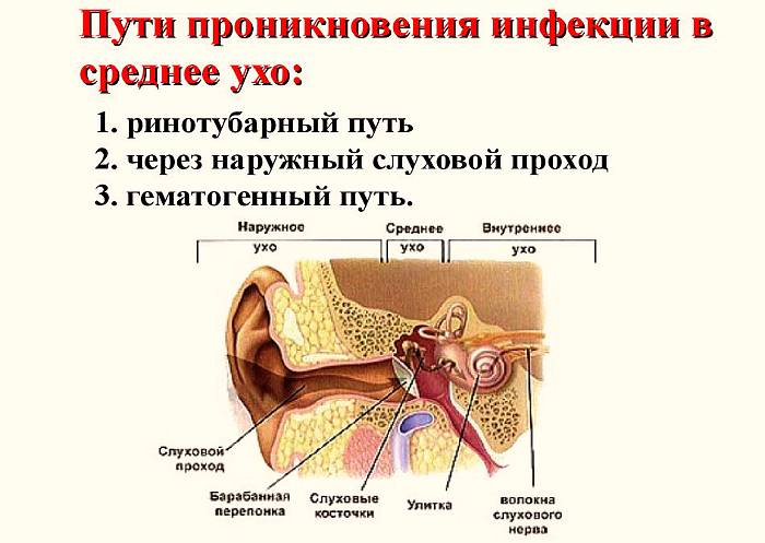 Пути проникновения инфекции в среднее ухо