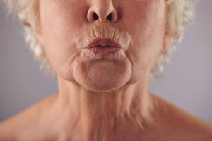 Одобренные дерматологом советы по устранению морщин вокруг рта