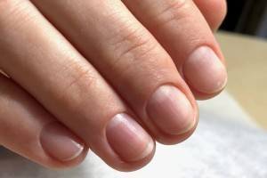 Симптомы и признаки заболеваний ногтей