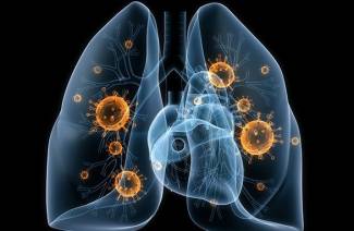 Что такое пневмония