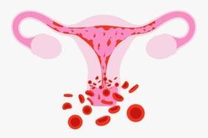 Менструальные сгустки: норма и патология