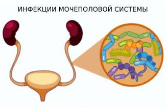 11 симптомов инфекции мочевыводящих путей