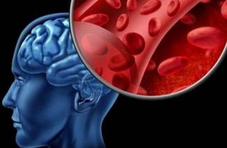 Как улучшить мозговое кровообращение