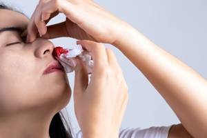 Кровотечение из носа, причины, как его предотвратить