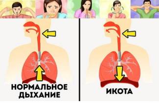 8 быстрых способов избавиться от икоты