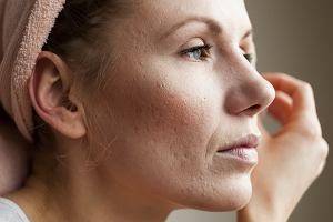5 натуральных масок для тусклой кожи