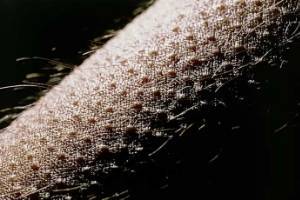Почему по коже «бегают» мурашки